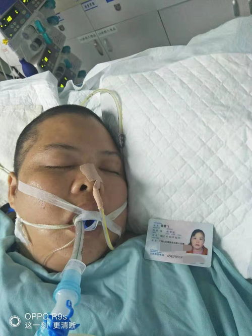 32岁网红下播后突发脑出血入ICU，从繁华到沉寂，人生的转折点