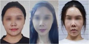 女子诈骗150万后整容换脸潜逃