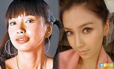 悲剧的背后，女子贷款整容手术身亡，留下1儿1女