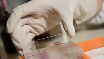 美女网红兽医感染布病第3次住院 美女网红兽医感染布病第3次住院